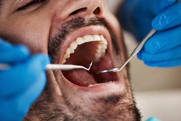 Best Emergency Treatment for Oral Infections in Wright, FL
